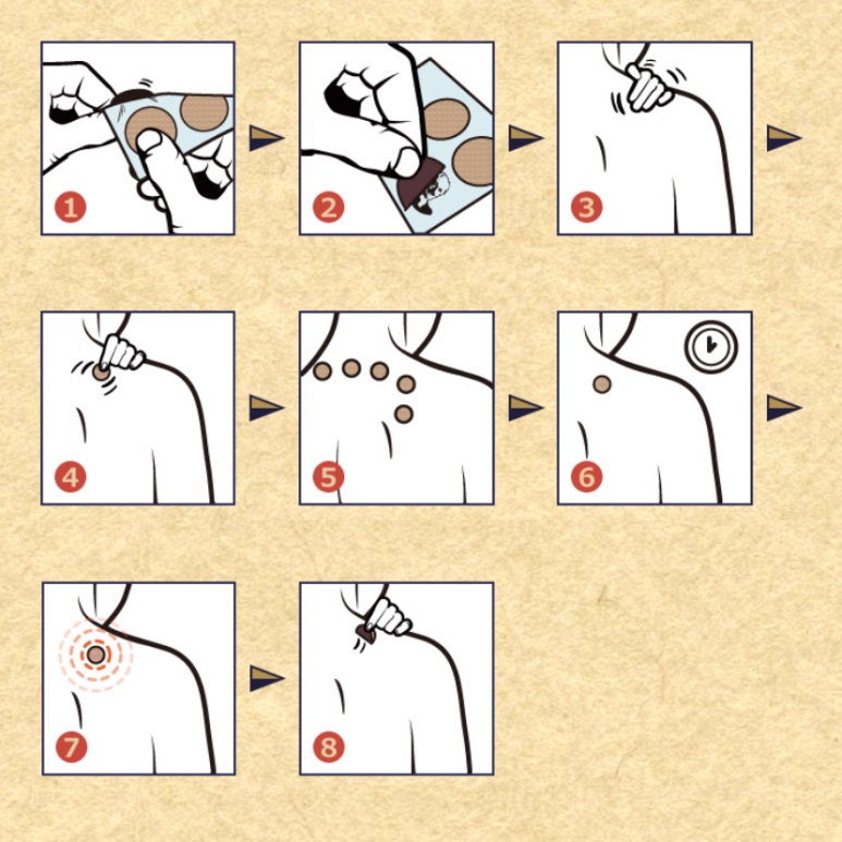 Step-by-step guide to applying a Roihi Tsubokou patch